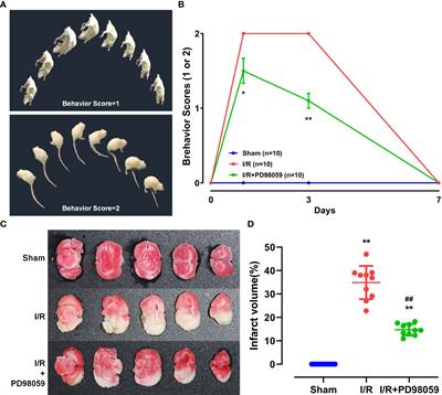 Hyperglycemia aggravates ischemic brain damage via ERK1/2 activated cell autophagy and mitochondrial fission